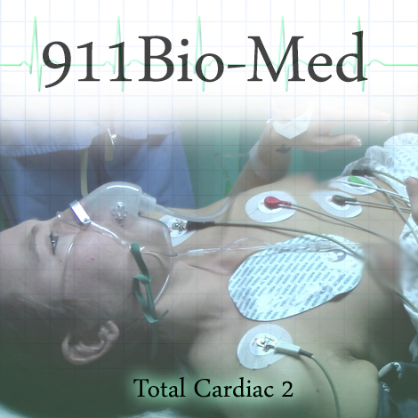 total cardiac p