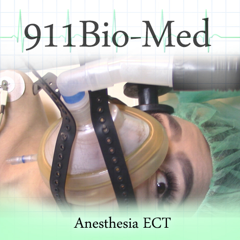 anesthesia-ect-p