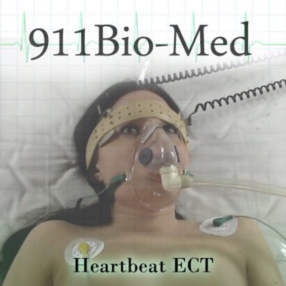 heartbeat ectP